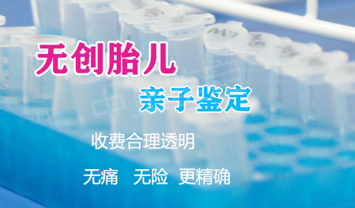 武汉产前亲子鉴定机构在哪儿, 武汉产前亲子鉴定机构在哪儿,